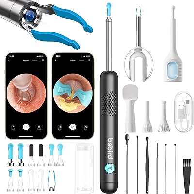 BEBIRD R1 Ultra Ohrenschmalz Entferner Kamera, Ohrenreiniger mit Otoskop für Zuhause, Komplett-Set mit Sichtbarer Dropper & Pinzette, Für Ohr & Nase & Rachen Untersuchung der Familie-Schwarze