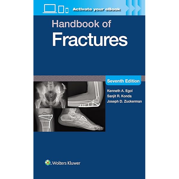 Rockwood and Wilkins' Fractures in Children: Print + eBook with