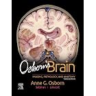 Osborn's Brain E-Book