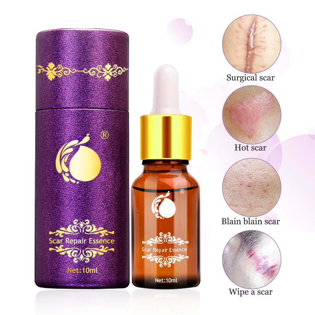 anti scarring oil