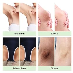 Vcetree Skin Bleaching Cream Skin Lightening for