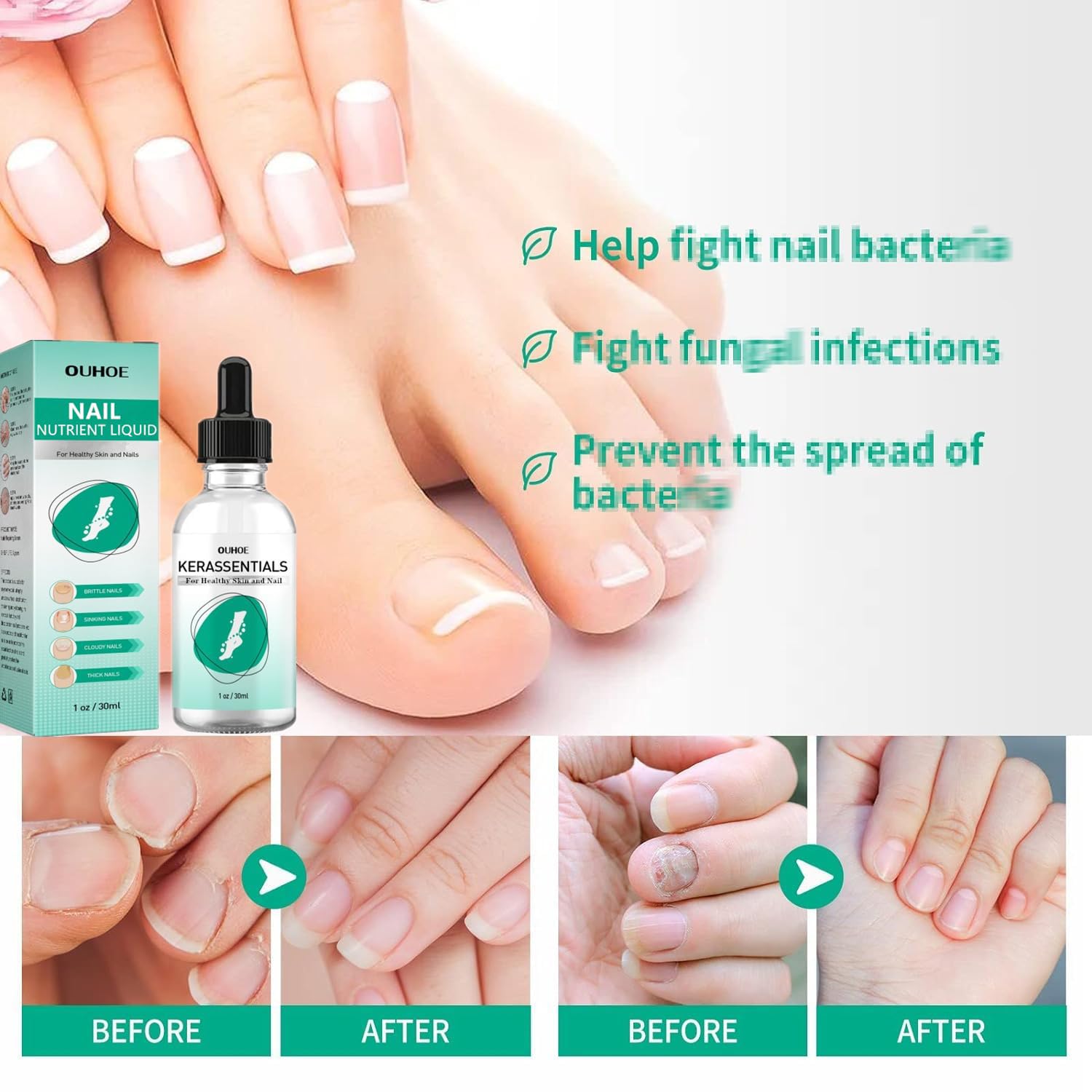 Kerassentials Toenail Oil, Kerassentials Nails colourless (3PCS) - Image 5