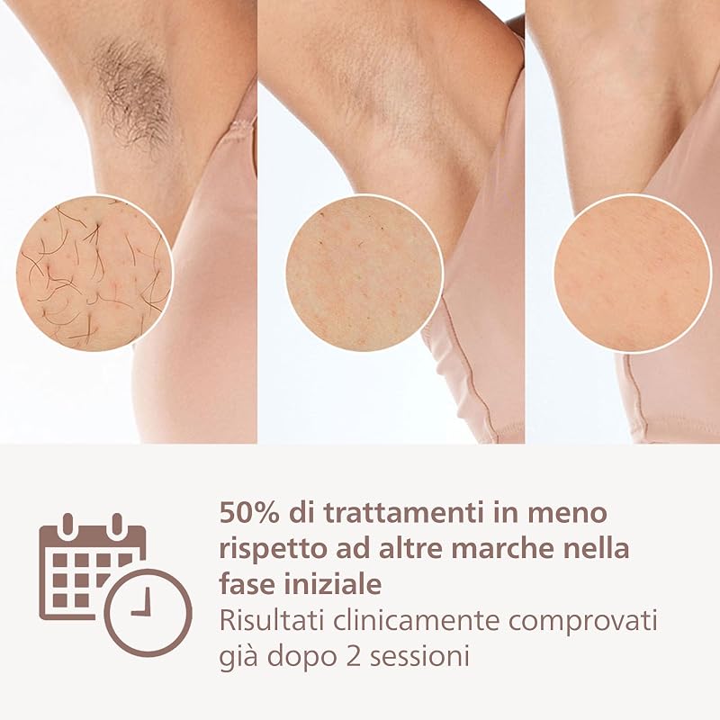 Lumea 8000 Series, dispositivo di epilazione IPL, alternativa ai dispositivi di epilazione laser, con tecnologia SenseIQ, 3 accessori per corpo, viso e zone di precisione, modello BRI946/00
