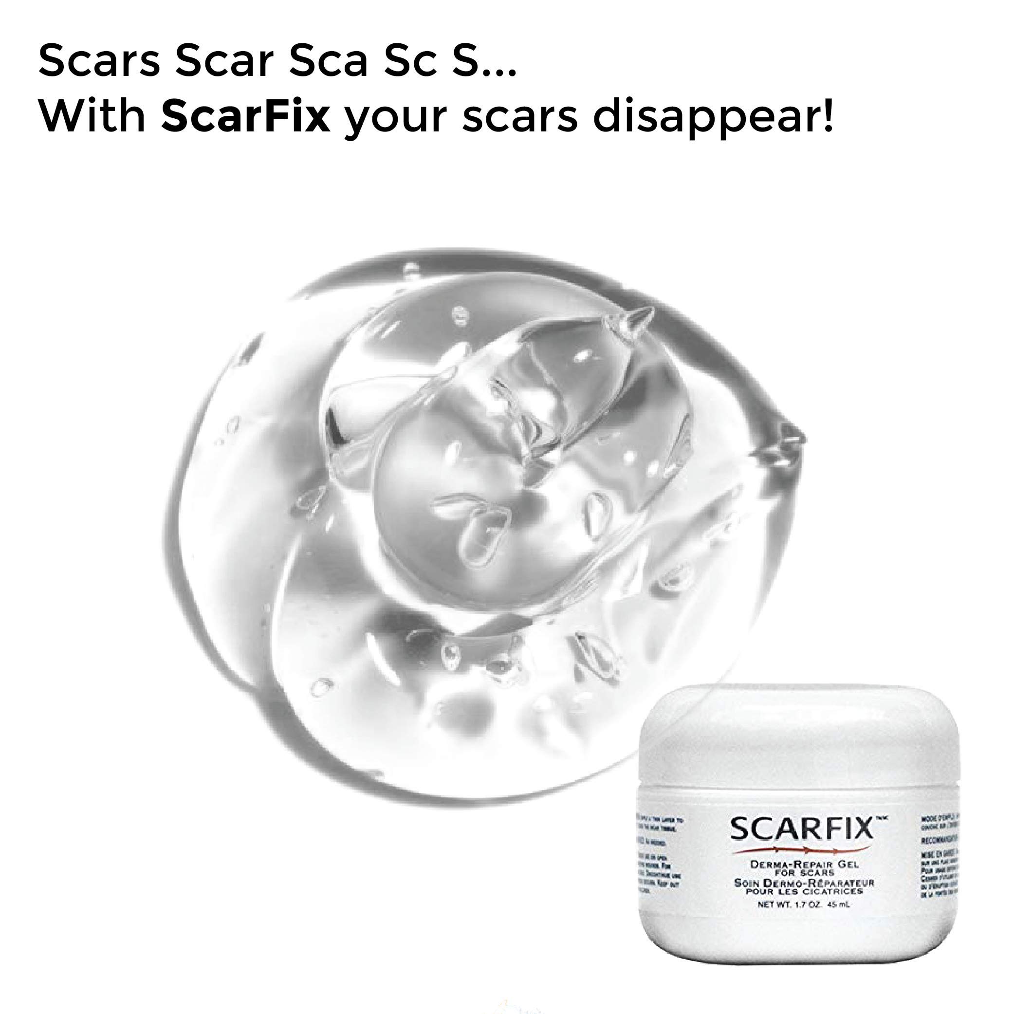 Scar Treatment Cream, Scar Removal Gel for Clearer and ScarFree Skin