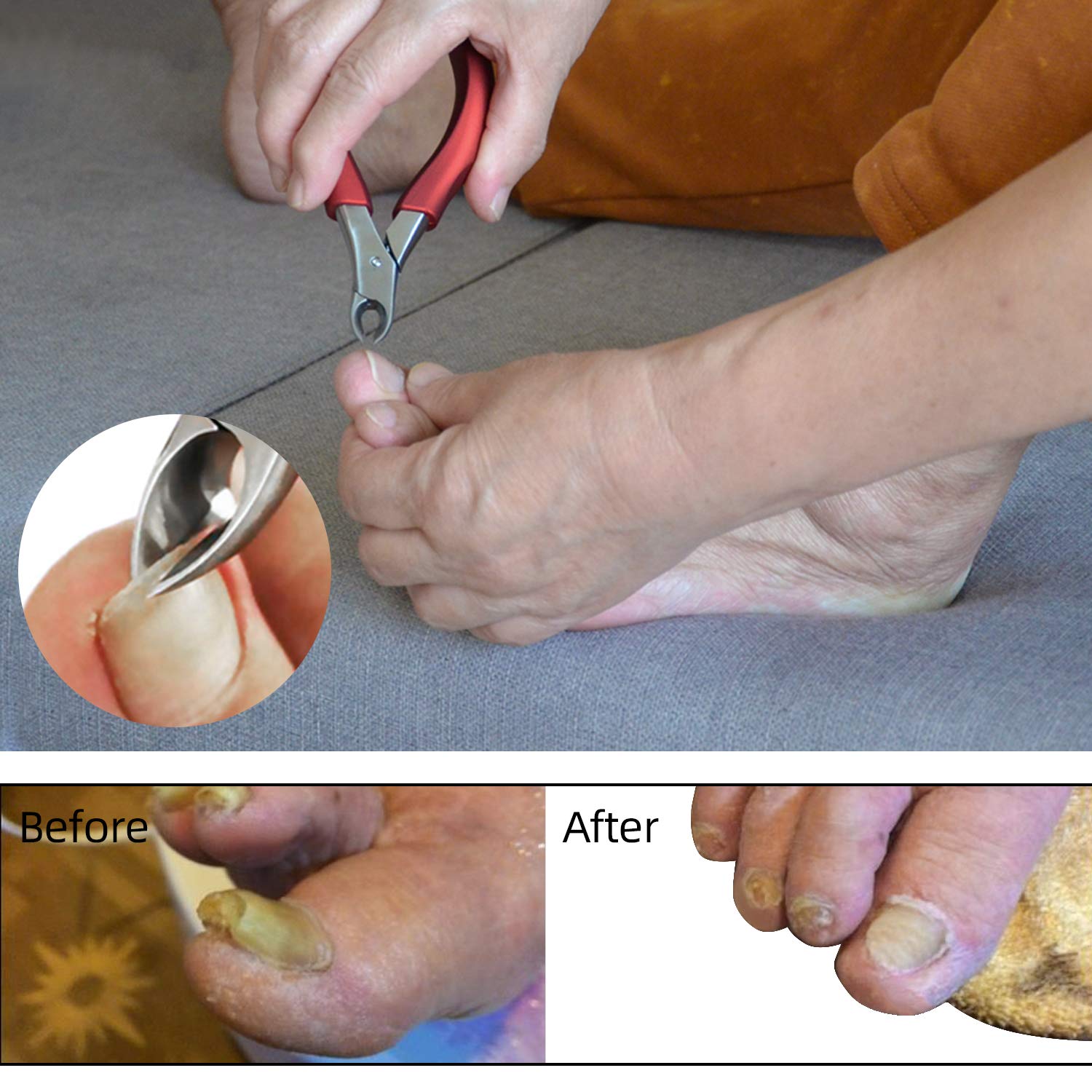 Toenail clippers for elderly, Used For Thick Toenails 、Fungi Toenails 、Ingrown Toenails. Long Handle, Leather Packaging, Safe Storage: Beauty