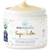 Superbalm USDA Organic Healing Ointment for Baby Eczema &amp; Cradle Cap - 2oz | 100% Natural Soothing Superfood Cream for Toddler &amp; Kids - Eczema, Cradle Cap, Baby Acne &amp; Rashes - Non-Toxic, Fragrance-Free