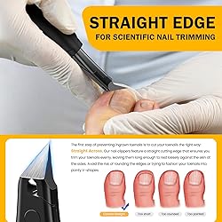 BEZOX Ingrown Toenail Clippers for Seniors, Slant