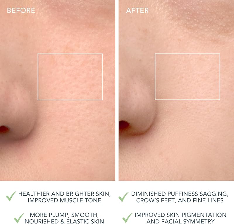 LUNA 4 Gesichtsreinigungsbürste - Straffende Gesichtsmassage - Anti-Aging-Pflege - Verbessert die Aufnahme von Gesichtspflegeprodukten - Einfache Gesichtspflege-Tools - Misch haut
