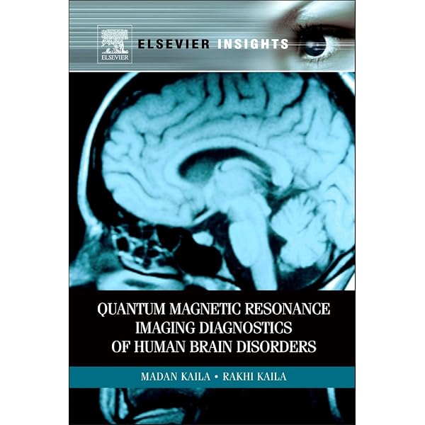 語学・辞書・学習参考書 fMRI: Functional Magnetic Resonance Imag
