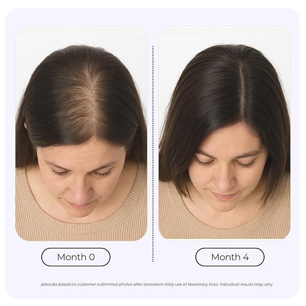 GROWPLEX ROSEMARY ELIXIR – DAILY SCALP OIL WITH 9 ESSENTIAL OILS – LIGHTWEIGHT, NON-GREASY FORMULA FOR A HEALTHY-LOOKING SCALP – FOR MEN & WOMEN – 2OZ