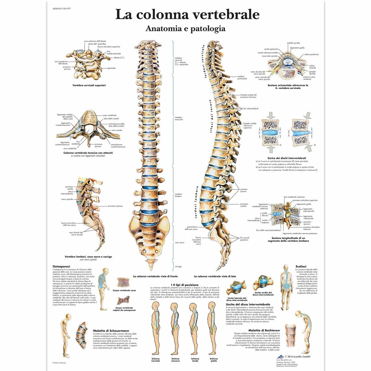 3B Scientific vr4152 The Vertebral Column, Anatomy and Pathology, 1