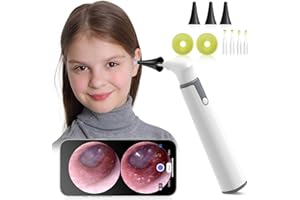 Anykit Wireless Otoscope Ear Camera with Dual View, 3.9mm 720PHD WiFi Ear Scope with Ear Wax Removal Tool for Kids and Adults & Pets, Compatible with Android and iPhone