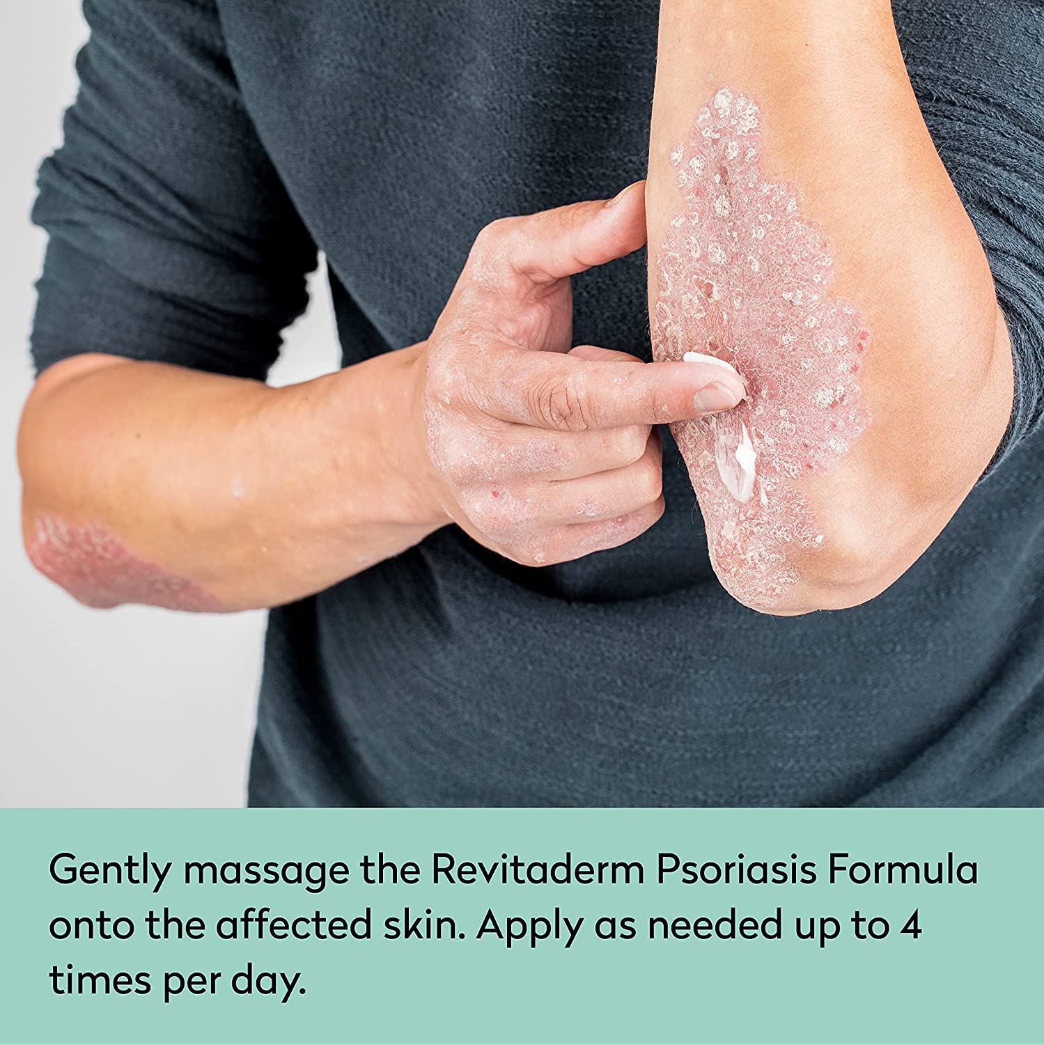 Dr. Blaine’s REVITADERM Psoriasis Formula - Topical Cream with Coal Tar, Tea Tree Oil and Lavender Oil for Itching, Flaking, Dry, Cracked Skin Relief - 4 fl. oz. - Includes Travel Size Bottle (2-Pack)