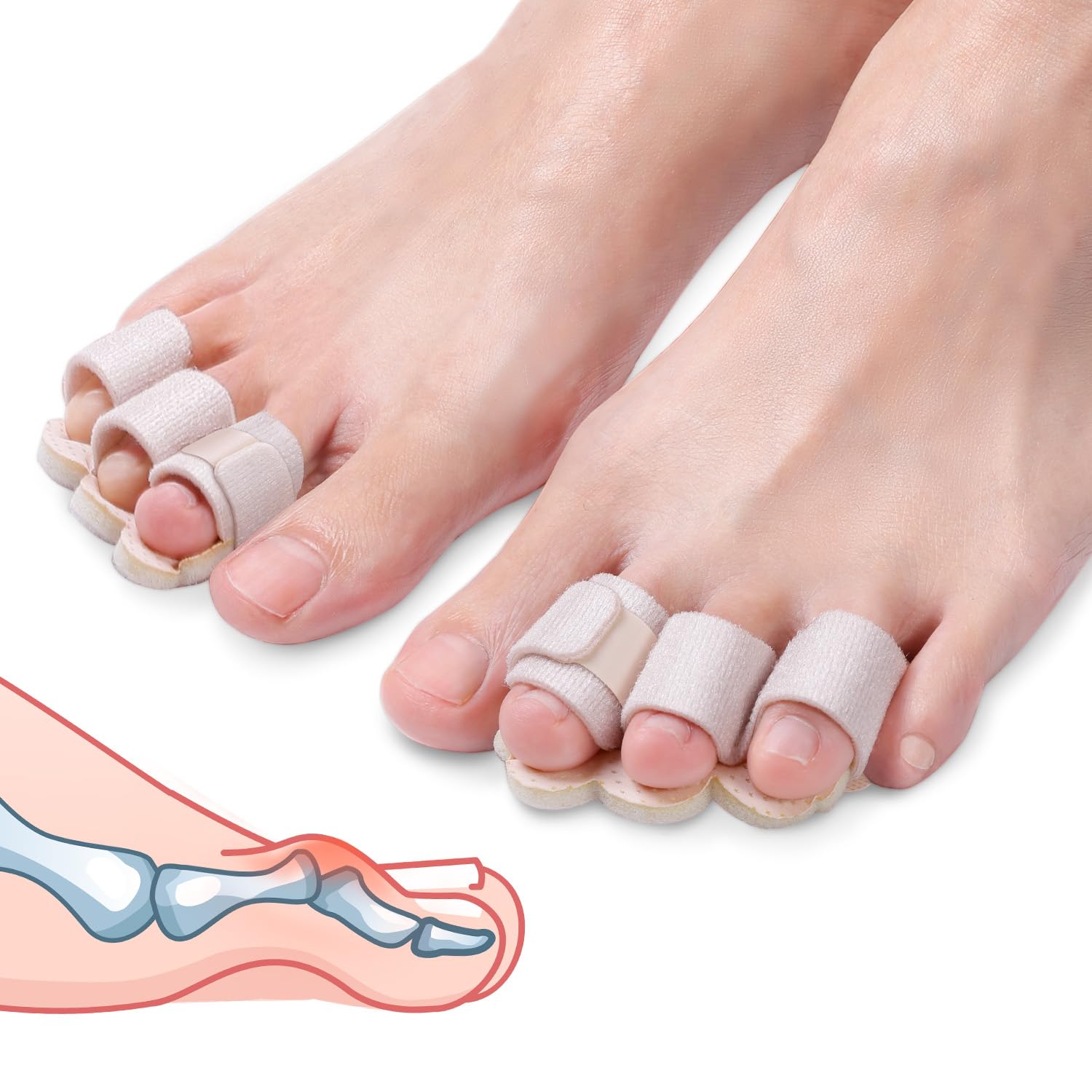 Photo 1 of Pozpo Tech Hammer Toe Straightener Corrector Splint Brace for Women fit 2nd 3rd and 4th Toes - (M-Beige) - 1 Pair