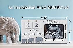 Sonogram Picture Frame, Ultrasound Photo Frame with