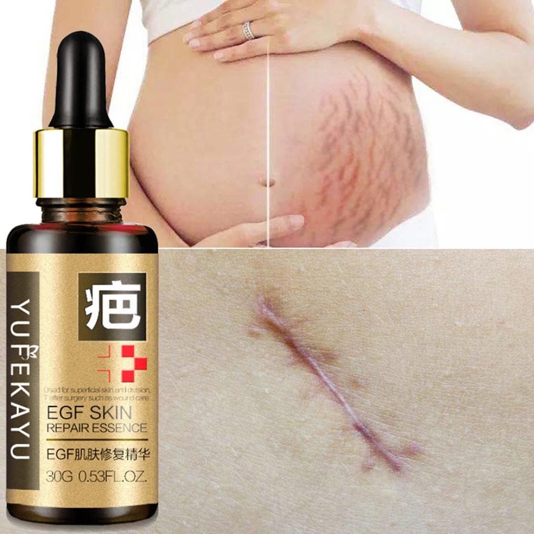 bio cream for stretch marks