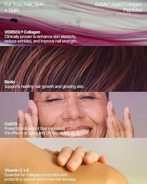 BEME BERADIANT LIQUID COLLAGEN PEPTIDE FOR HAIR, SKIN & NAILS WITH 2X FASTER ABSORPTION – CLINICALLY TESTED – 2500MG VERISOL® HYDROLYZED COLLAGEN SUPPLEMENTS FOR WOMEN WITH BIOTIN, COQ10 & VITAMIN C