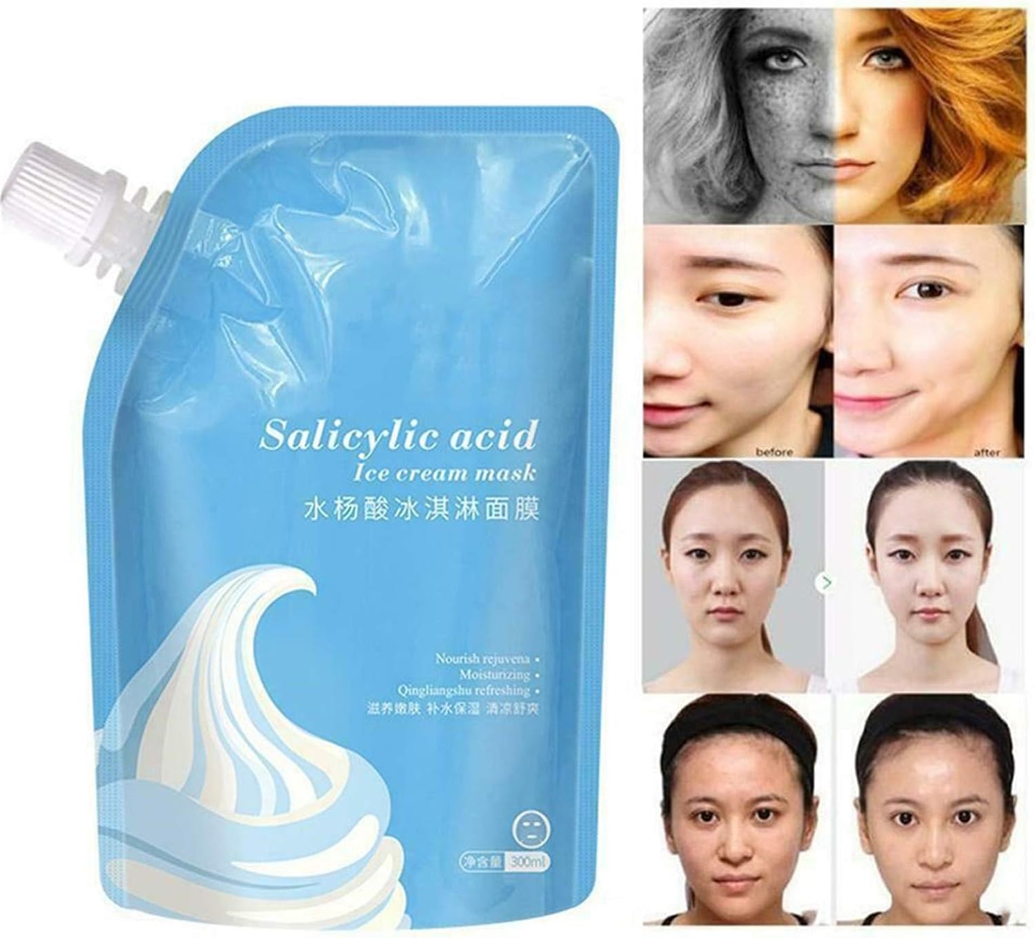 bleaching hyperpigmentation on face