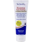 TriDerma Fast Healing Eczema Cream for Adults, FSA Eligible, Colloidal Oats, AP4 Aloe Vera Gel, Vitamins, Eczema Relief Cream for Face &amp; Body Itchy Skin &amp; Rashes, No Cortisone or Fragrance - 4.2oz