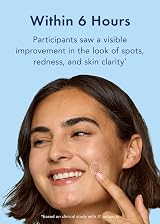 Rael Miracle Retinol Pimple Patches - Hydrocolloid Acne Spot Cover 72ct view 5
