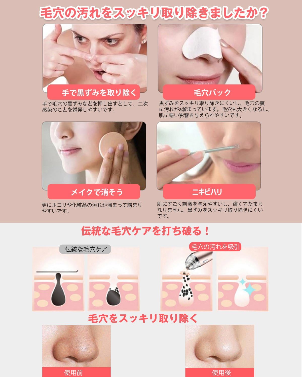 Amazon Homysnug 毛穴吸引器 スポットクリア 2019年最新発売 メーカー直販 ４つ吸引ヘッド 3段階吸引力調整可能 ニキビ 毛穴の汚れ 皮脂 黒ずみ 角質取り 皮膚改善 毛穴の汚れを吸引 毛穴クリーナー 持ちやすい ロマンチックピンク Usb充電式 一年保証期間が