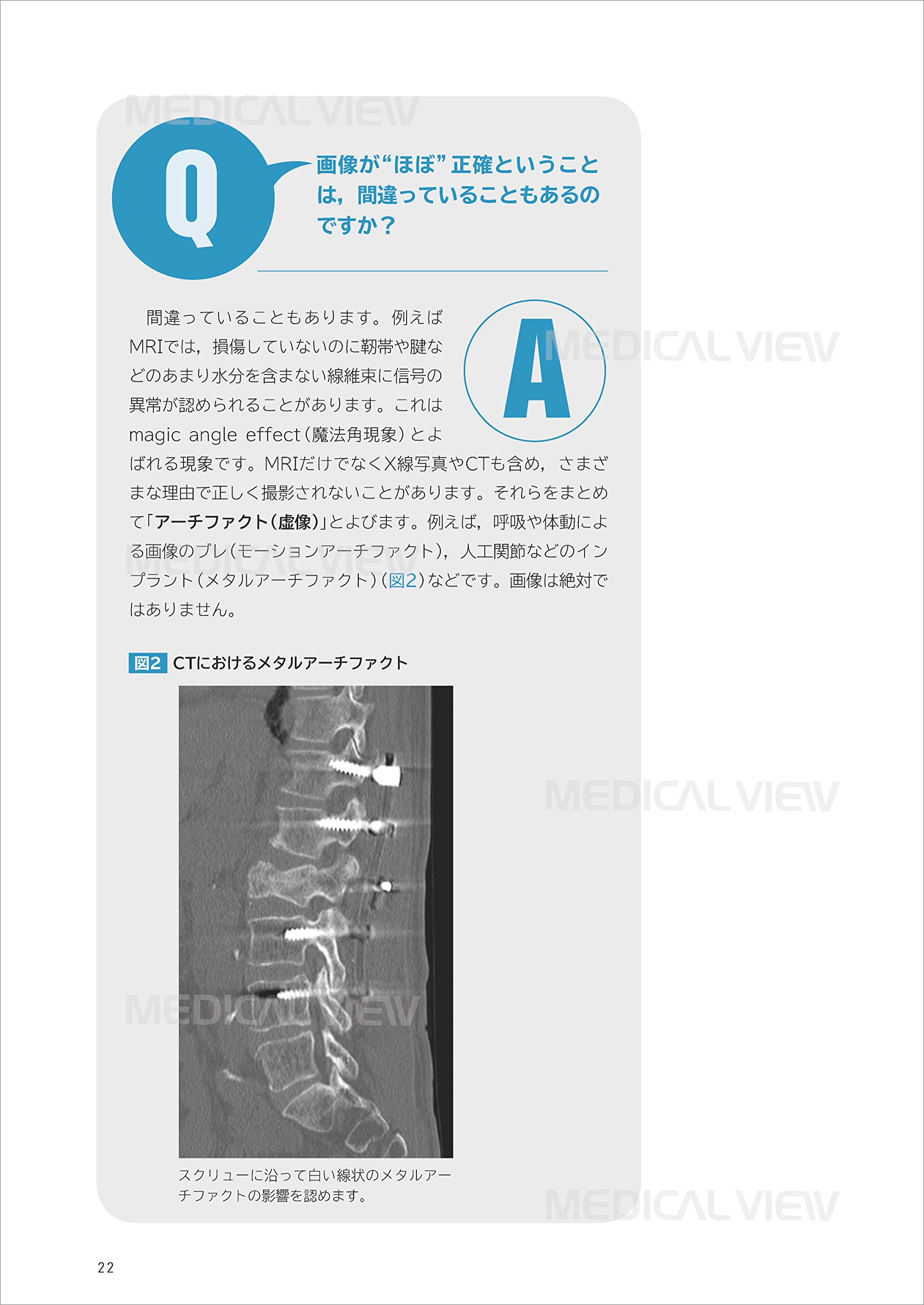 リハで読むべき運動器画像 瀧田 勇二 塩野 寛大 本 通販 Amazon リハで読むべき運動器画像 瀧田 勇二 塩野 寛大 本 通販 Amazon