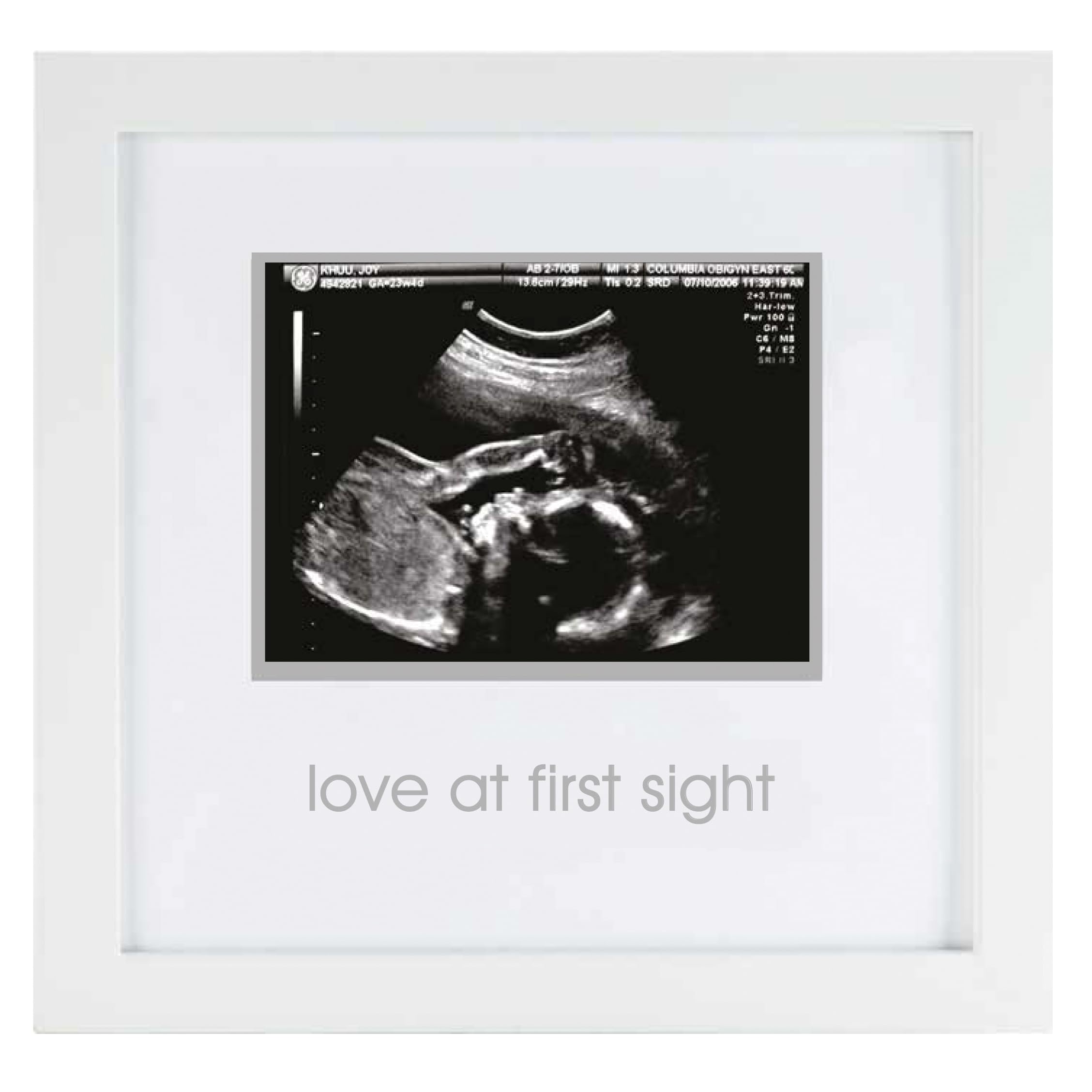 Pearhead Love at First Sight Sonogram Picture Frame, Gender Neutral Ultrasound Keepsake, Ideal Pregnancy Gift, Baby Shower and Nursery Decor, White