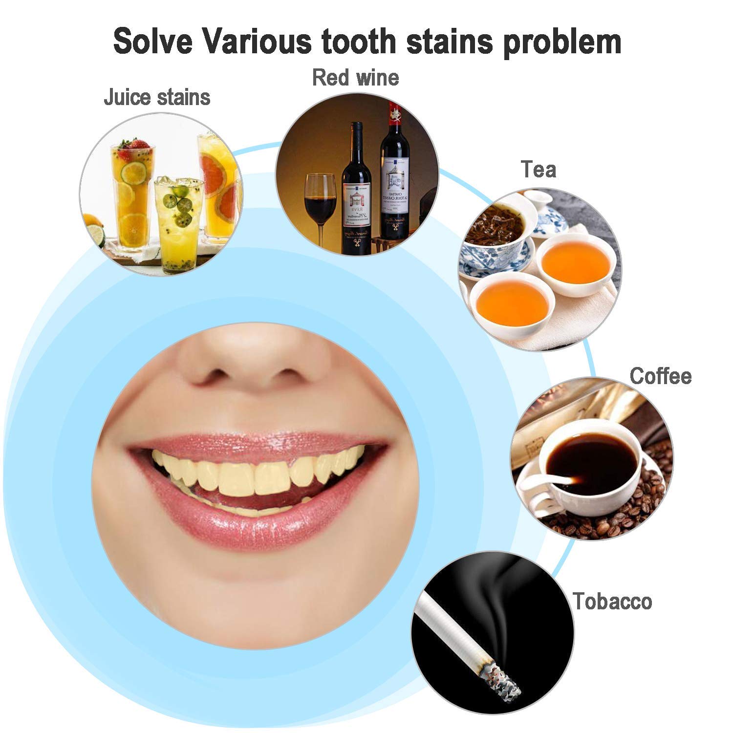 UNDOMIEL Teeth Whitening Kit Xpassion Professional Tooth Whiten Gel Dental Care Home Bleaching Kit for White Teeth Including 12 Teeth Whitening Gel