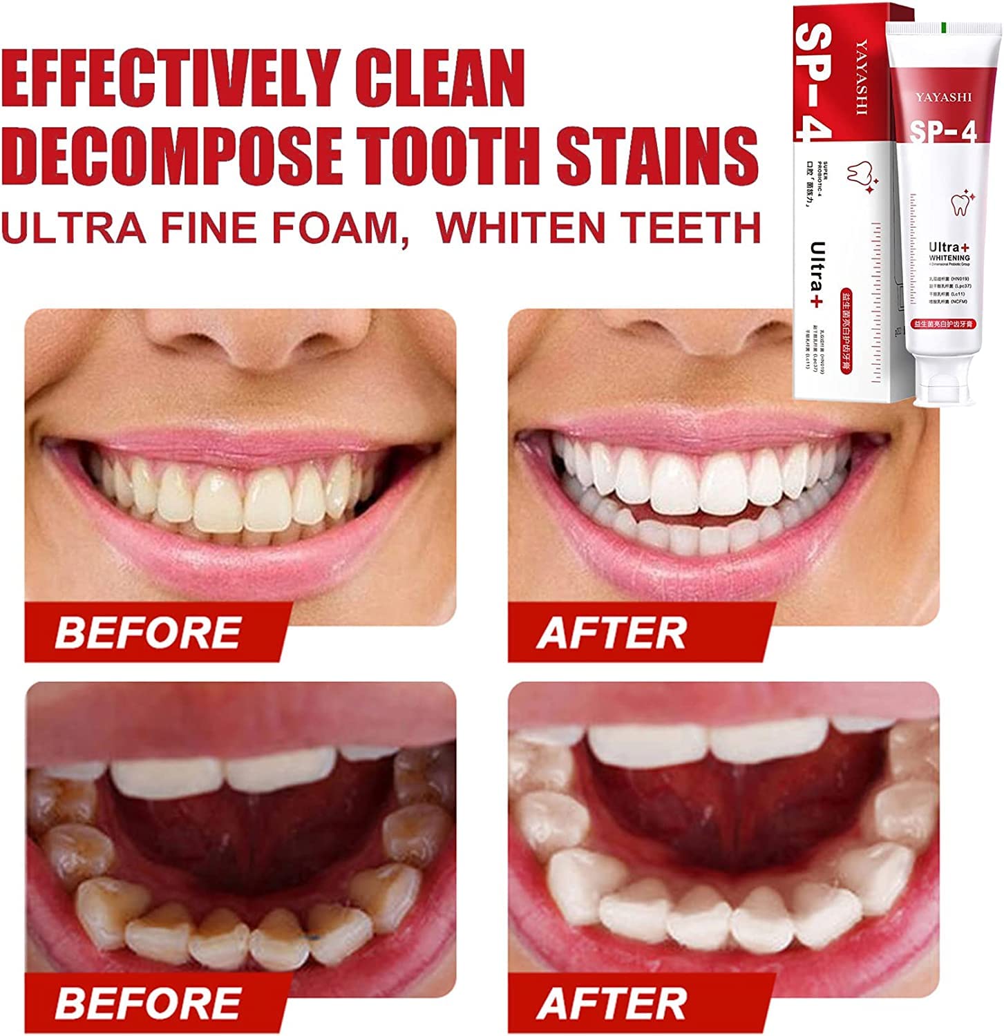 Sp-4 Probiotic Whitening Toothpaste, Ultra Whitening Toothpaste, Sp-4 Ultra Whitening (Red)
