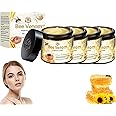 Turanu Bee Venom Skin Treatment Cream, 2024 New Bee Venom Cream for Removing and Repair, Professional Bee Venom Treatment Cream, Natural Bee Venom skin repair cream for All Parts of The Body (4 Pack)