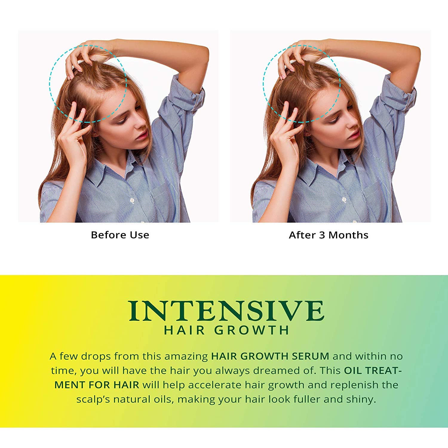 Lumanere Hair Growth Serum Hair Growth Oil with Biotin 2 Pack – Natural Hair Growth Accelerator for Stronger, Thicker, Longer Hair for Men and Women 1.7 Oz : Beauty