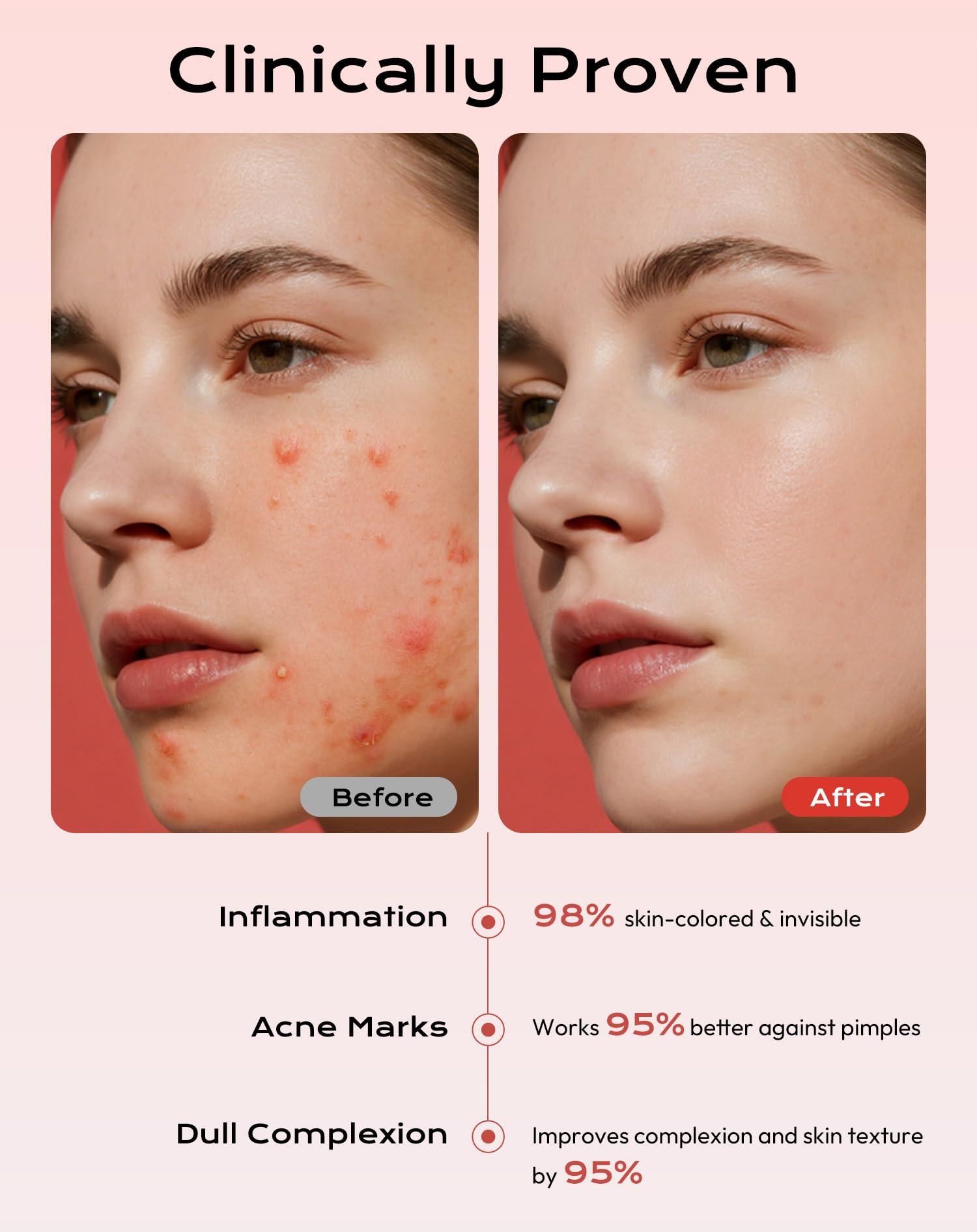 360 Pieces Invisible Pimple Patches, Hydrocolloid Spot Patches, Acne Treatment with 10mm & 12mm Dots for Spots, Waterproof & Breathable