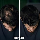 FIXXIE Hairline Powder Root Touch Up Hair Loss Concealer Black view 9