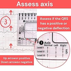 ECG 7 Step Ruler, ECG/EKG 7 Step Ruler Card for