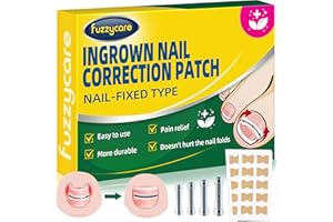 FUZZYCARE Large Size-Titanium Alloy Ingrown Toenail Treatment & Removal Kit for Quick Relief, Ingrown Toenail Removal Kit， Professional Ingrown Toenail Corrector, Ingrown Toenail Tools for Quick Relief, 10 Pcs