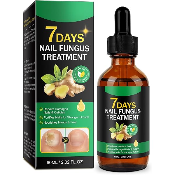 Ginger Nagelpflege-Set Mit Ingwer-Öl & Aloe-Vera-Stift – Für Brüchige Nägel & Trockene Nagelhaut