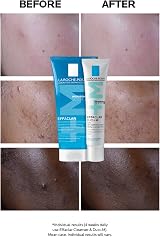 La Roche-Posay Effaclar Duo+M Anti-Breakout Moisturiser Salicylic Acid view 2
