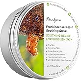 Peralpow Frankincense Resin Soothing Salve - Organic Coconut Oil & Beeswax - Moisturizing Balm for Dry - Sensitive Skin - Vegan Safe - 1.76 oz