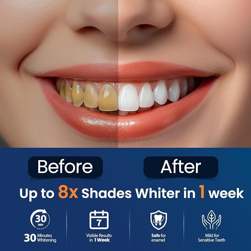 tiras blanqueadoras dientes blanqueador dental - blanqueadores dentales teeth 28 Piezas whitening strips dientes 14 Tratamientos blanqueamiento dental blancos Seguro para Esmalte Refresca Respiración — foto 4 de 7