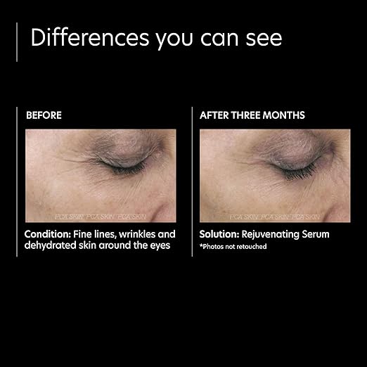 pca rejuvenating serum
