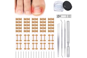 HOIUTER Professional Ingrown Toenail Corrector, 2026 Upgraded Ingrown Toenail Removal Kit with U-shaped Correction Strips, Ingrown Nail Corrector Home Care Set-Effective Corrector Ingrown Toenails (Black)