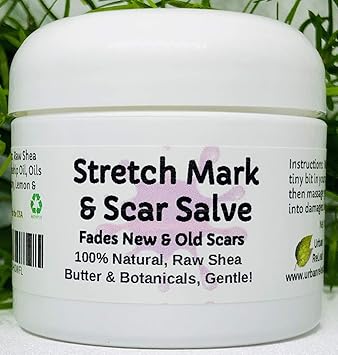 vitamin rich moisturizer for stretch marks