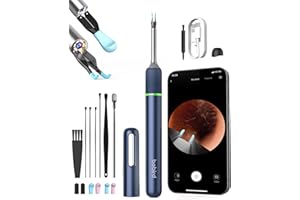 BEBIRD PRO Ear Wax Removal Tool with Camera:Bebird Note 5 Ear Cleaner with Otoscope and Light,Visual Earwax Cleaning Kit with Ear Pick & Tweezers,3 in 1 Ear Scope WiFi Earwax Remover for Ear Picking (Blue)