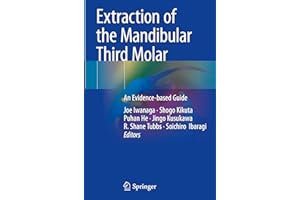 Extraction of the Mandibular Third Molar: An Evidence-based Guide