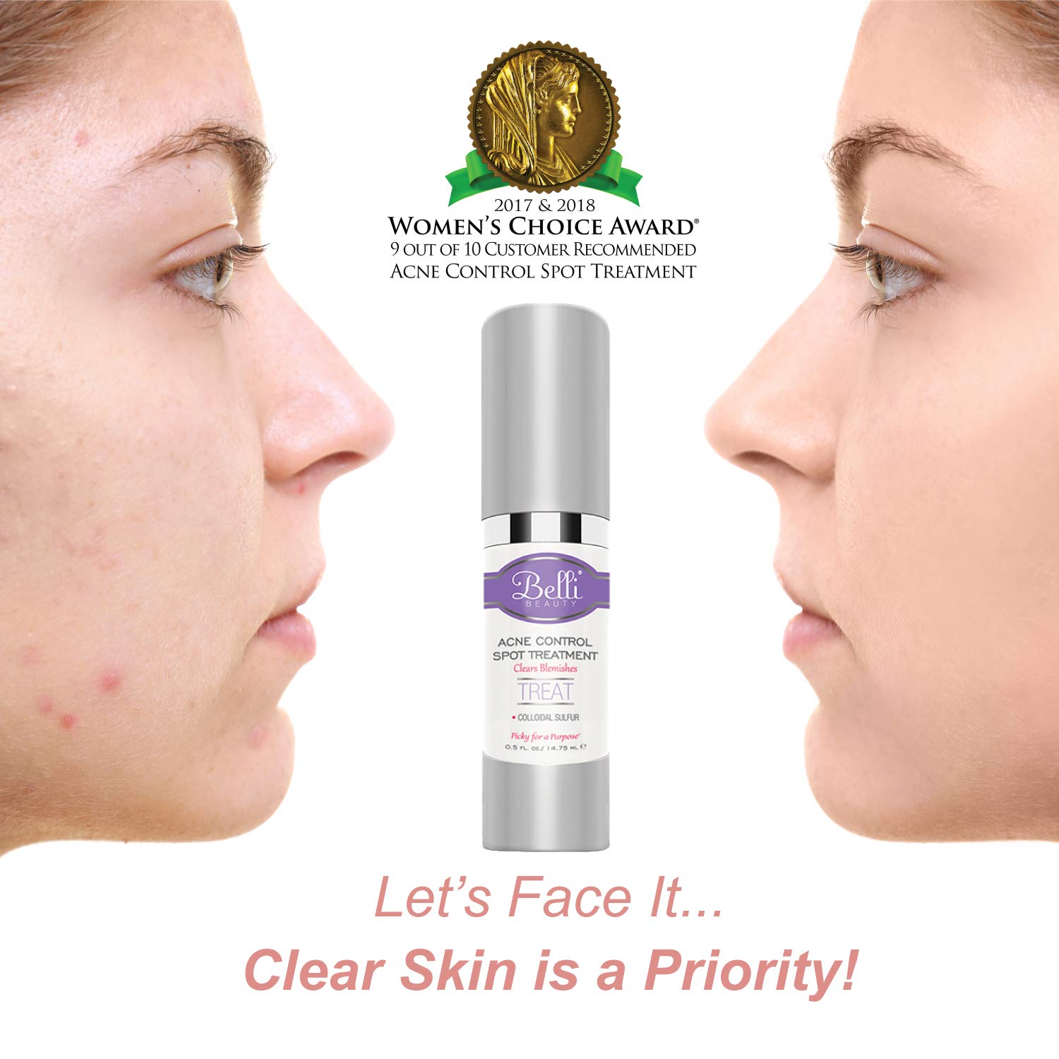 Belli Acne Control Spot Treatment – Clears Blemishes and Helps Prevent