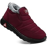 SHIBEVER Winter Boots for Women: Warm Fur Lined Slip on Ankle Snow Boots Comfortable Waterproof Anti-slip Outdoor Shoes