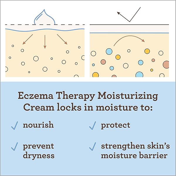 AVEENO BABY ECZEMA THERAPY NIGHTTIME BODY BALM, MOISTURIZING ECZEMA TREATMENT, CERAMIDES, TRIPLE OAT COMPLEX, SOOTHES DRY, ITCHY SKIN, HYPOALLERGENIC, FRAGRANCE & STEROID FREE, 11OZ