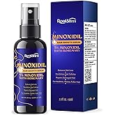 5% Minoxidil Hair Growth for Men and Women: Extra Strength Minoxidil Kit Hair Loss Treatment Serum with Rosemary for Faster Stronger Thicker Hair Growth 2 Fl Oz