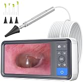 ScopeAround Otoscope with 4.5" IPS Screen, 3.9mm Ear Camera with Gyroscope | No App /WiFi Needed, Photo &amp; Video Recording, 32GB Card, 6 LED Lights, Easy to Use Digital Otoscope for Safe Home Ear Checker