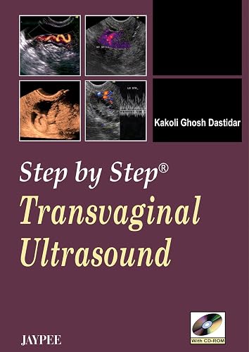 Download Transvaginal Ultrasound PDF